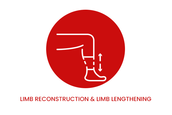 Limb Reconstruction & Limb Lengthening